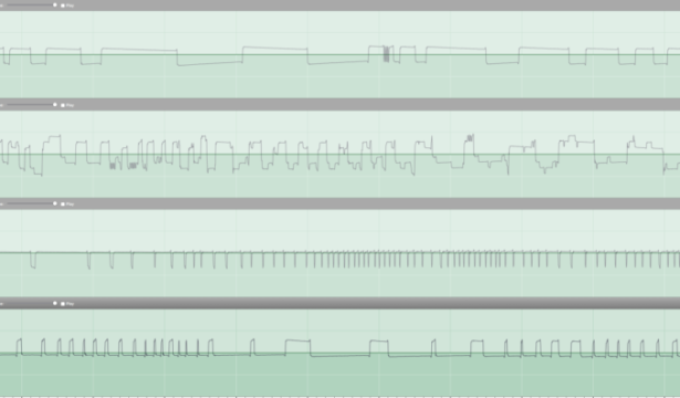 GenDynish – Xenakis on the Arduino